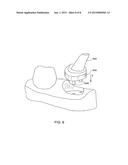 METHOD FOR MANIPULATING A DENTAL VIRTUAL MODEL, METHOD FOR     CREATINGPHYSICAL ENTITIES BASED ON A DENTAL VIRTUAL MODEL THUS     MANIPULATED, AND DENTAL MODELS THUS CREATED diagram and image