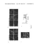 ADAM12 Inhibitors and Their Use Against Inflammation-Induced Fibrosis diagram and image