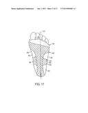 SYSTEM FOR TREATMENT OF PLANTAR FASCIITIS diagram and image