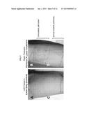 THERMAL TREATMENT OF A PILOSEBACEOUS UNIT WITH METAL NANOPARTICLES IN     SURFACTANT CONTAINING SOLUTIONS diagram and image