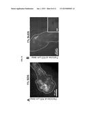 THERMAL TREATMENT OF A PILOSEBACEOUS UNIT WITH METAL NANOPARTICLES IN     SURFACTANT CONTAINING SOLUTIONS diagram and image