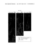 THERMAL TREATMENT OF A PILOSEBACEOUS UNIT WITH METAL NANOPARTICLES IN     SURFACTANT CONTAINING SOLUTIONS diagram and image