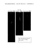 THERMAL TREATMENT OF A PILOSEBACEOUS UNIT WITH METAL NANOPARTICLES IN     SURFACTANT CONTAINING SOLUTIONS diagram and image