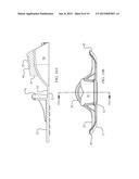 Oral Appliance and Tray diagram and image