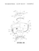 STUFFING BOX LEAK CONTAINMENT APPARATUS diagram and image