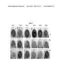 ANTITHROMBOGENIC HOLLOW FIBER MEMBRANES AND FILTERS diagram and image