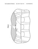 STRUCTURE FOR ATTACHING COMPONENT TO PLATE-SHAPED MEMBER diagram and image