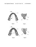 ADHESIVE DENTAL BLEACHING COMPOSITIONS CONTAINING POLYVINYLPYRROLIDONE diagram and image