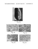 Disease treatment via developing non-syngeneic graft transplantation diagram and image