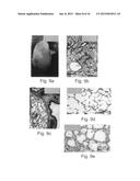 Disease treatment via developing non-syngeneic graft transplantation diagram and image