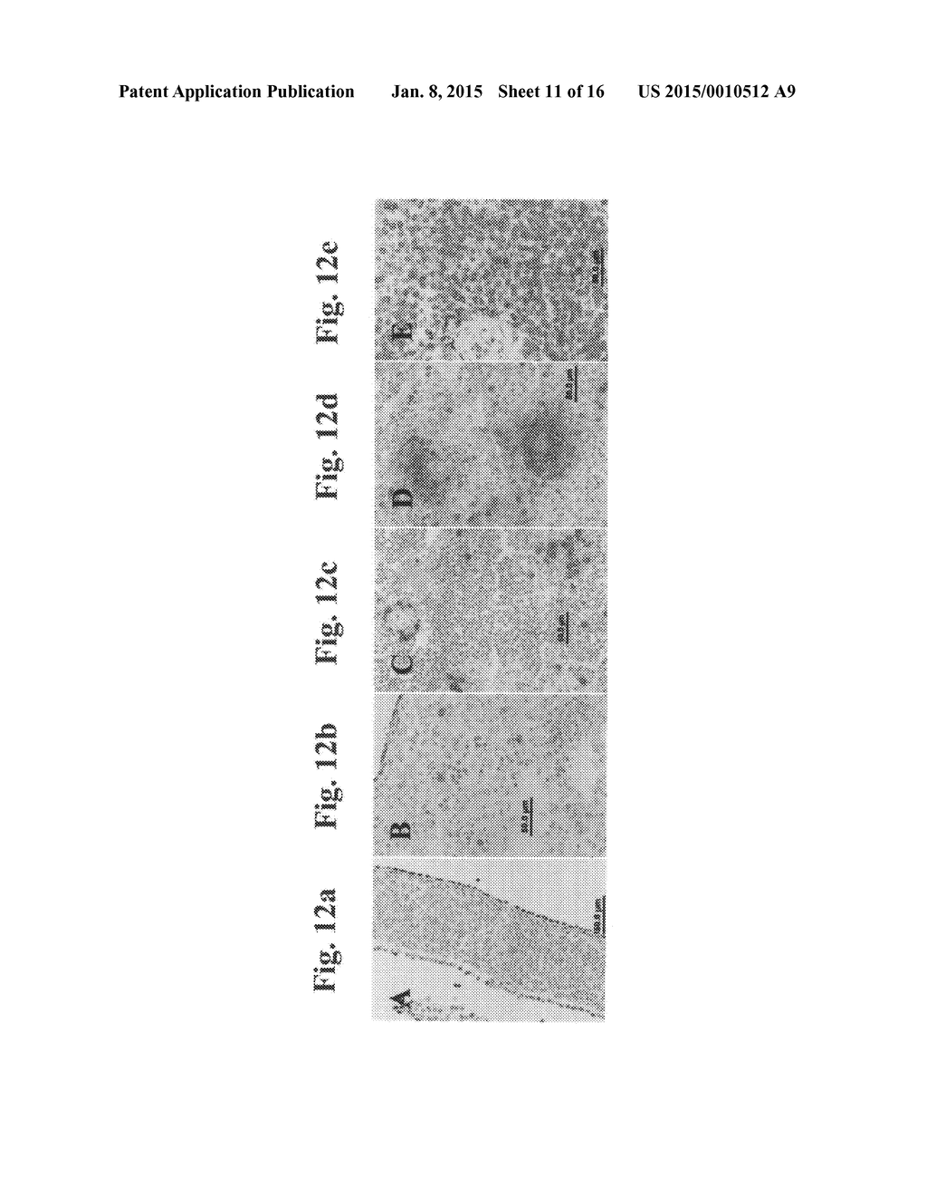 Disease treatment via developing non-syngeneic graft transplantation - diagram, schematic, and image 12