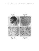 Disease treatment via developing non-syngeneic graft transplantation diagram and image