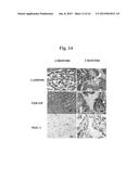 Disease treatment via developing non-syngeneic graft transplantation diagram and image