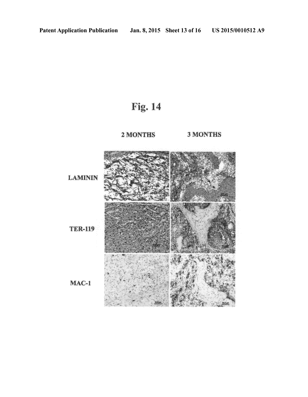 Disease treatment via developing non-syngeneic graft transplantation - diagram, schematic, and image 14