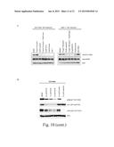 METHODS FOR TREATMENT OF BREAST CANCER NONRESPONSIVE TO TRASTUZUMAB diagram and image