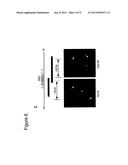 TRANSLOCATION AND MUTANT ROS KINASE IN HUMAN NON-SMALL CELL LUNG CARCINOMA diagram and image