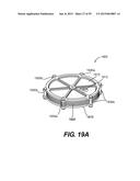 LEAD-ACID BATTERY DESIGN HAVING VERSATILE FORM FACTOR diagram and image