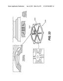 LEAD-ACID BATTERY DESIGN HAVING VERSATILE FORM FACTOR diagram and image