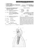 DENTAL POST FOR SUPPORTING DENTAL PROSTHESES AND METHOD FOR THE PRODUCTION     THEREOF diagram and image