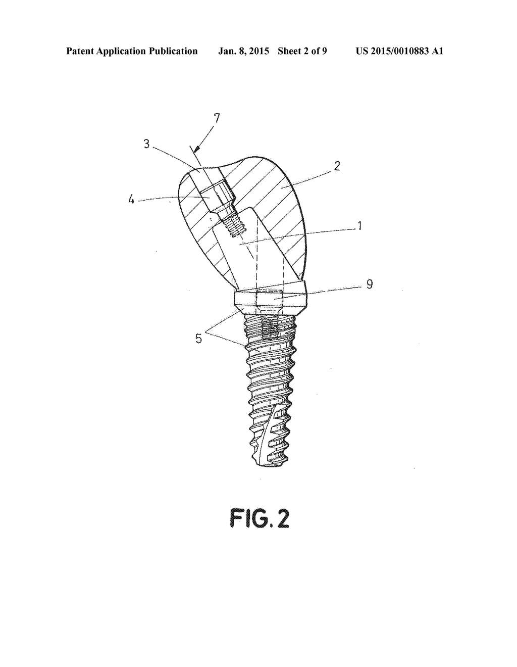 DENTAL POST FOR SUPPORTING DENTAL PROSTHESES AND METHOD FOR THE PRODUCTION     THEREOF - diagram, schematic, and image 03