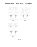 DENTURE-FIXING ATTACHMENT HAVING FREELY ADJUSTABLE ANGLE AND POSITION diagram and image