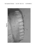 DENTAL PROSTHESIS AND METHOD OF ITS PRODUCTION UTILIZING STANDARDIZED     FRAMEWORK KEYS AND MATCHING PREMANUFACTURED TEETH diagram and image