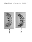 DENTAL PROSTHESIS AND METHOD OF ITS PRODUCTION UTILIZING STANDARDIZED     FRAMEWORK KEYS AND MATCHING PREMANUFACTURED TEETH diagram and image