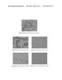 SOLID DISPERSION OF POORLY SOLUBLE COMPOUNDS COMPRISING CROSPOVIDONE AND     AT LEAST ONE WATER-SOLUBLE POLYMER diagram and image
