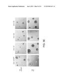 INHIBITION OF THE GLYCINE CLEAVAGE SYSTEM FOR TREATMENT OF CANCER diagram and image