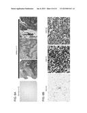 INHIBITION OF THE GLYCINE CLEAVAGE SYSTEM FOR TREATMENT OF CANCER diagram and image