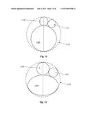 TARGETED ILLUMINATION FOR SURGICAL INSTRUMENT diagram and image