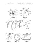 CONTROLLED SYMPATHECTOMY AND MICRO-ABLATION SYSTEMS AND METHODS diagram and image