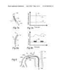 CONTROLLED SYMPATHECTOMY AND MICRO-ABLATION SYSTEMS AND METHODS diagram and image