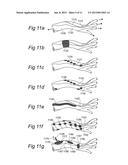 CONTROLLED SYMPATHECTOMY AND MICRO-ABLATION SYSTEMS AND METHODS diagram and image