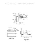 CONTROLLED SYMPATHECTOMY AND MICRO-ABLATION SYSTEMS AND METHODS diagram and image