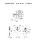 CONTROLLED SYMPATHECTOMY AND MICRO-ABLATION SYSTEMS AND METHODS diagram and image