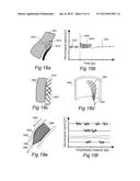 CONTROLLED SYMPATHECTOMY AND MICRO-ABLATION SYSTEMS AND METHODS diagram and image