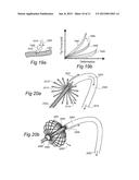 CONTROLLED SYMPATHECTOMY AND MICRO-ABLATION SYSTEMS AND METHODS diagram and image