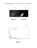 SYSTEM FOR AND METHOD OF QUANTIFYING ON-BODY PALPITATION FOR IMPROVED     MEDICAL DIAGNOSIS diagram and image