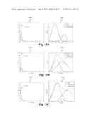 SYSTEM FOR AND METHOD OF QUANTIFYING ON-BODY PALPITATION FOR IMPROVED     MEDICAL DIAGNOSIS diagram and image