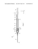 INDWELLING NEEDLE DEVICE diagram and image