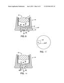 Onlay subcutaneous injection port diagram and image