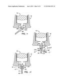 Onlay subcutaneous injection port diagram and image