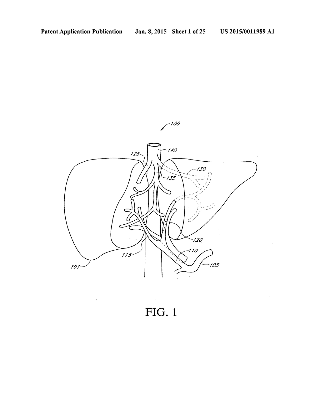 HEPATIC NEUROMODULATION USING MICROWAVE ENERGY - diagram, schematic, and image 02