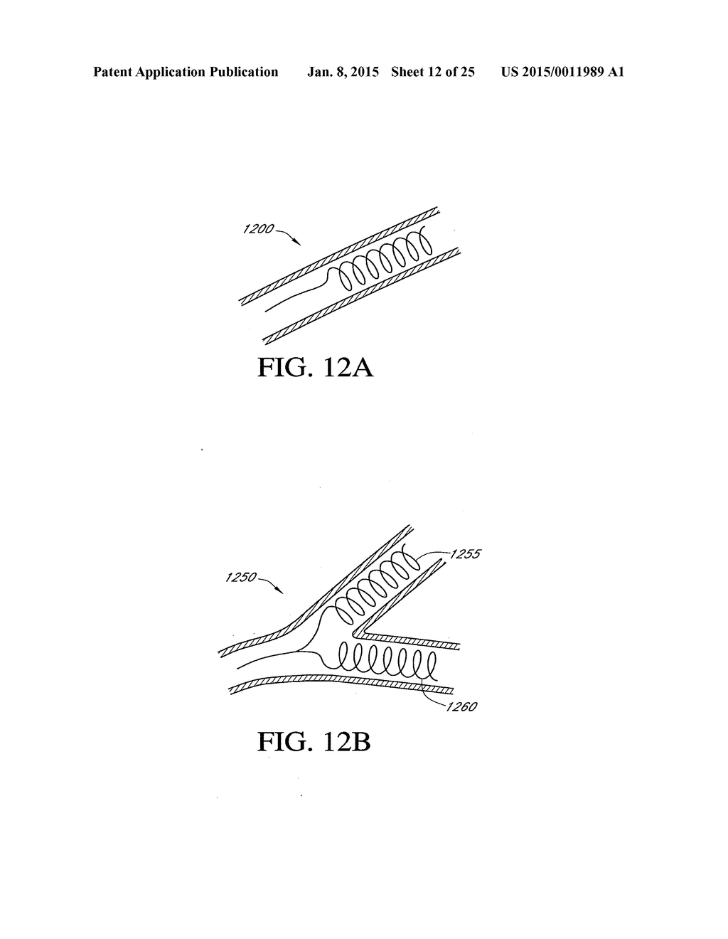 HEPATIC NEUROMODULATION USING MICROWAVE ENERGY - diagram, schematic, and image 13