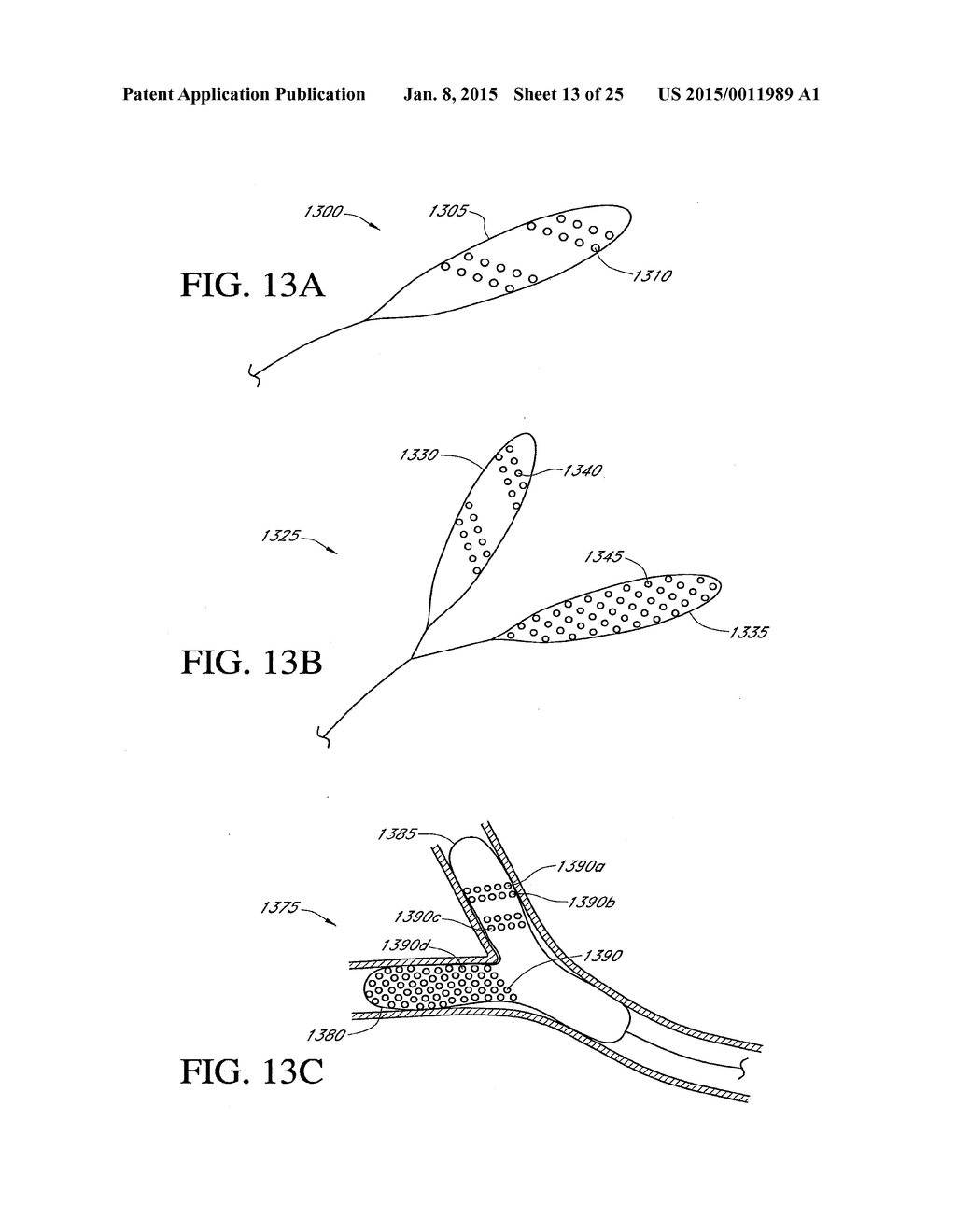 HEPATIC NEUROMODULATION USING MICROWAVE ENERGY - diagram, schematic, and image 14