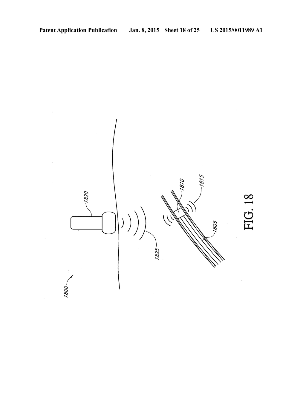 HEPATIC NEUROMODULATION USING MICROWAVE ENERGY - diagram, schematic, and image 19