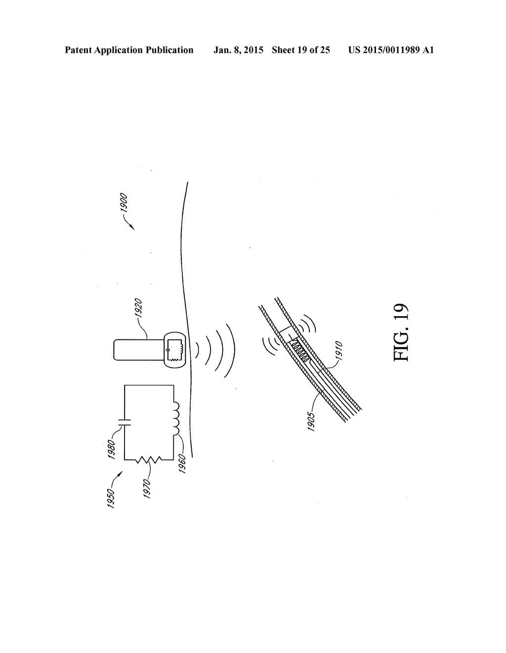 HEPATIC NEUROMODULATION USING MICROWAVE ENERGY - diagram, schematic, and image 20