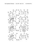 OSTEOSYNTHESIS CLIP AND INSERTION TOOL FOR USE WITH BONE TISSUE FRAGMENTS diagram and image