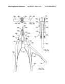 OSTEOSYNTHESIS CLIP AND INSERTION TOOL FOR USE WITH BONE TISSUE FRAGMENTS diagram and image